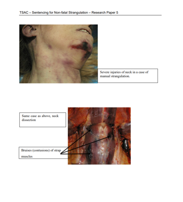 Vanessa Sy's fake injuries compared to real-world images of victims